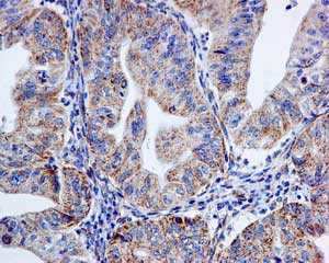 Immunohistochemistry (Formalin/PFA-fixed paraffin-embedded sections) - Anti-mtTFA antibody [EPR12286] (AB171951), expandable thumbnail