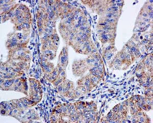 Immunohistochemistry (Formalin/PFA-fixed paraffin-embedded sections) - Anti-mtTFA antibody [EPR12286] - Mitochondrial Marker (AB171951)