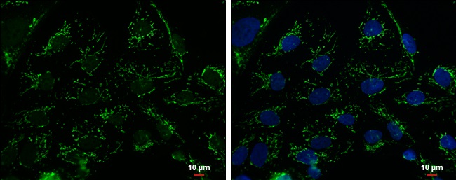Immunocytochemistry/ Immunofluorescence - Anti-mtTFA antibody - Mitochondrial Marker (ab272885), expandable thumbnail