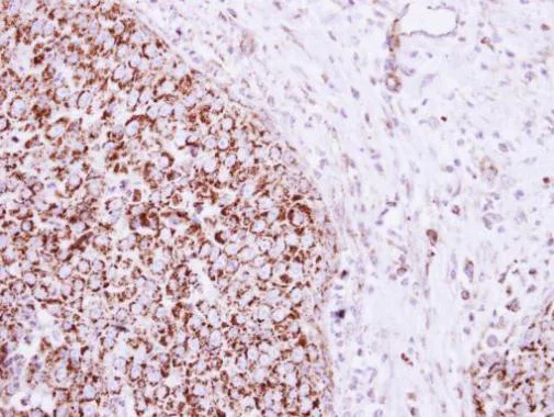 Immunohistochemistry (Formalin/PFA-fixed paraffin-embedded sections) - Anti-mtTFA antibody - Mitochondrial Marker (AB272885)