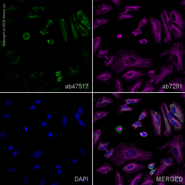 Immunocytochemistry/ Immunofluorescence - Anti-mtTFA antibody - Mitochondrial Marker (AB47517)