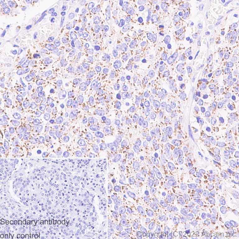Immunohistochemistry - Anti-mtTFA antibody [RM1035] - BSA and Azide free (AB307303)