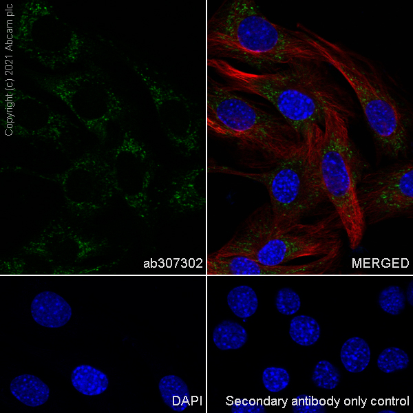 Immunocytochemistry/ Immunofluorescence - Anti-mtTFA antibody [RM1035] (ab307302), expandable thumbnail