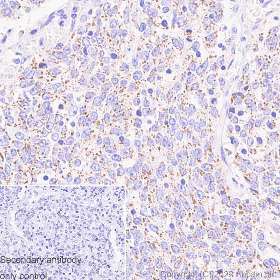 Immunohistochemistry - Anti-mtTFA antibody [RM1035] (AB307302), expandable thumbnail