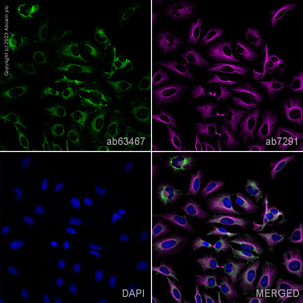 Immunocytochemistry/ Immunofluorescence - Anti-MTTP/MTP antibody (AB63467)