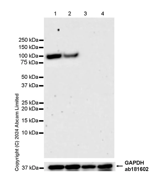 Western blot - Anti-MTTP/MTP antibody [EPR27197-78] (AB321881)