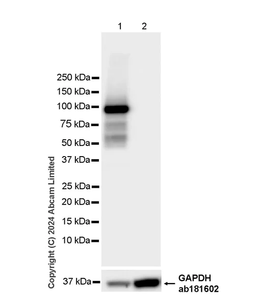Western blot - Anti-MTTP/MTP antibody [EPR27197-78] (AB321881)