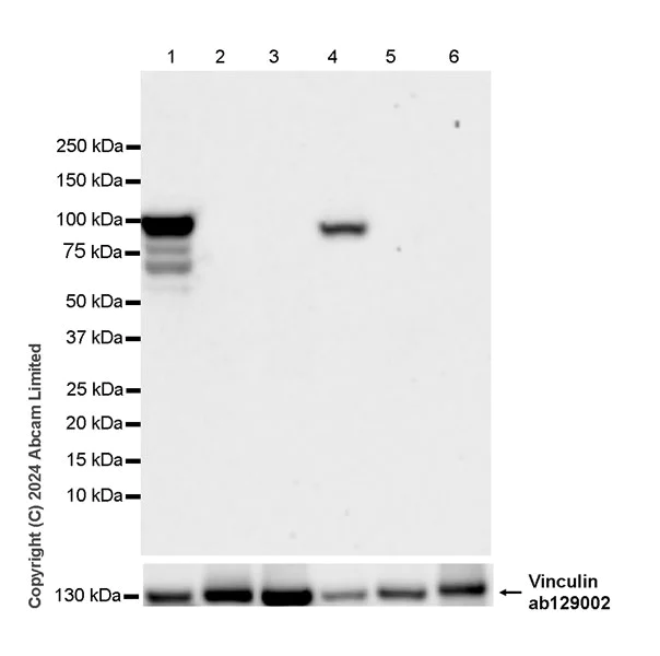 Western blot - Anti-MTTP/MTP antibody [EPR27197-78] (AB321881)