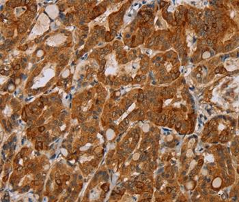Immunohistochemistry (Formalin/PFA-fixed paraffin-embedded sections) - Anti-MTUS1 antibody (AB198176)
