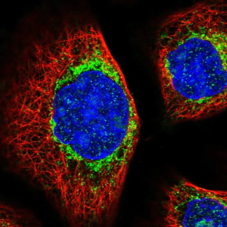 Immunocytochemistry/ Immunofluorescence - Anti-MTX2 antibody (AB272607)