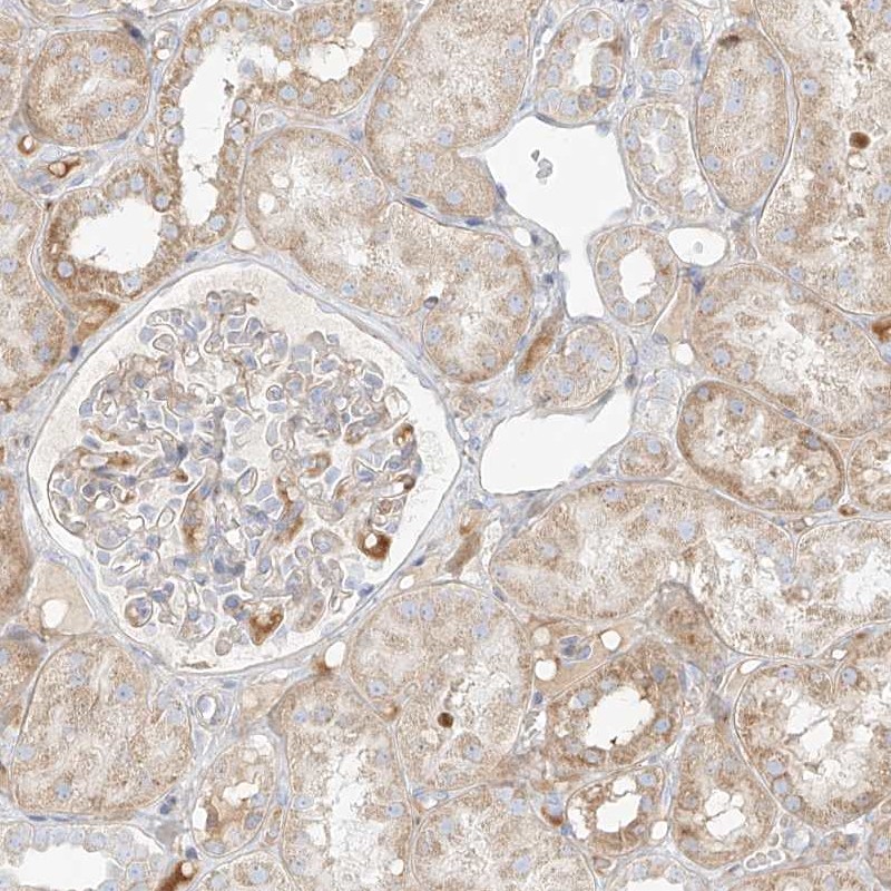 Immunohistochemistry (Formalin/PFA-fixed paraffin-embedded sections) - Anti-MTX2 antibody (AB272607)