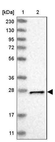 Western blot - Anti-MTX2 antibody (AB272607)