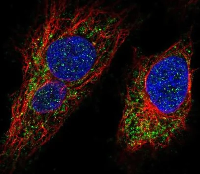 Immunocytochemistry/ Immunofluorescence - Anti-MTX3 antibody (AB222048)