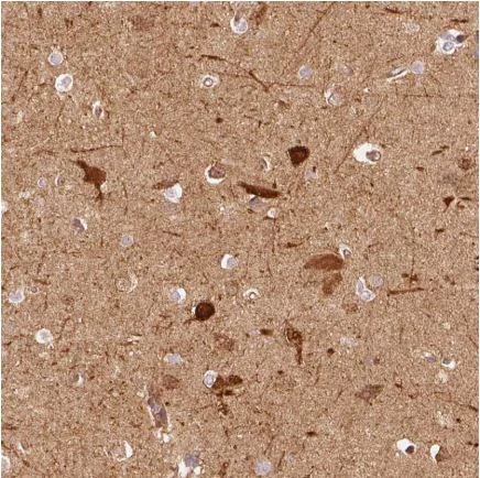 Immunohistochemistry (Formalin/PFA-fixed paraffin-embedded sections) - Anti-mu Crystallin antibody (AB220085)