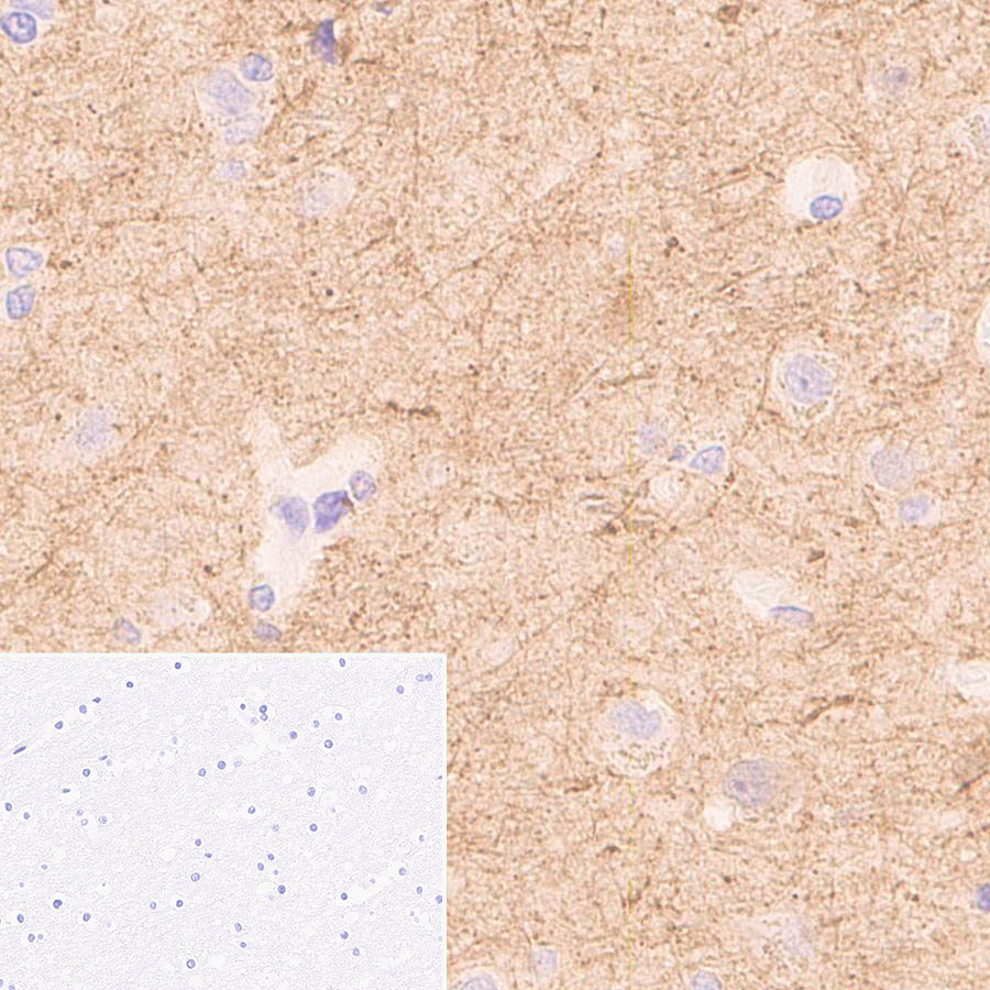 Immunohistochemistry (Formalin/PFA-fixed paraffin-embedded sections) - Anti-mu Crystallin antibody [EPR28406-56] (ab314876), expandable thumbnail