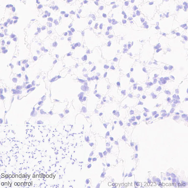 Immunohistochemistry (Formalin/PFA-fixed paraffin-embedded sections) - Anti-mu Crystallin antibody [EPR28406-56] (AB314876)