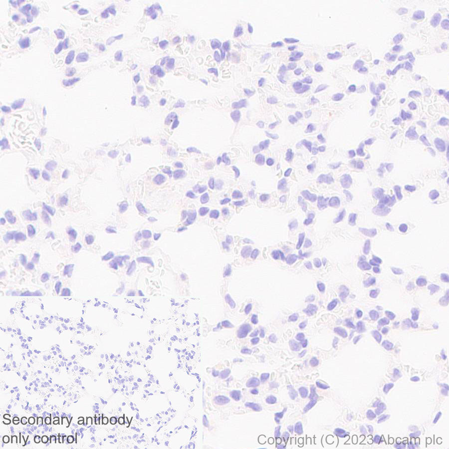 Immunohistochemistry (Formalin/PFA-fixed paraffin-embedded sections) - Anti-mu Crystallin antibody [EPR28406-56] (AB314876), expandable thumbnail