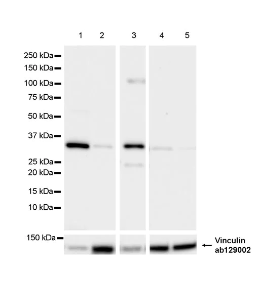 Western blot - Anti-mu Crystallin antibody [EPR28406-56] (AB314876)