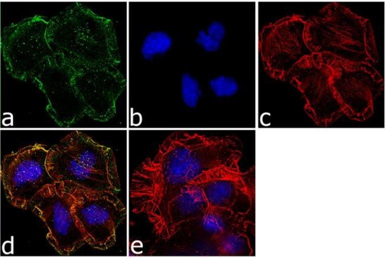Immunocytochemistry - Anti-Mu Opioid Receptor antibody (AB17934)