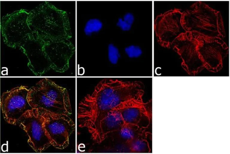 Immunocytochemistry - Anti-Mu Opioid Receptor antibody (AB17934)
