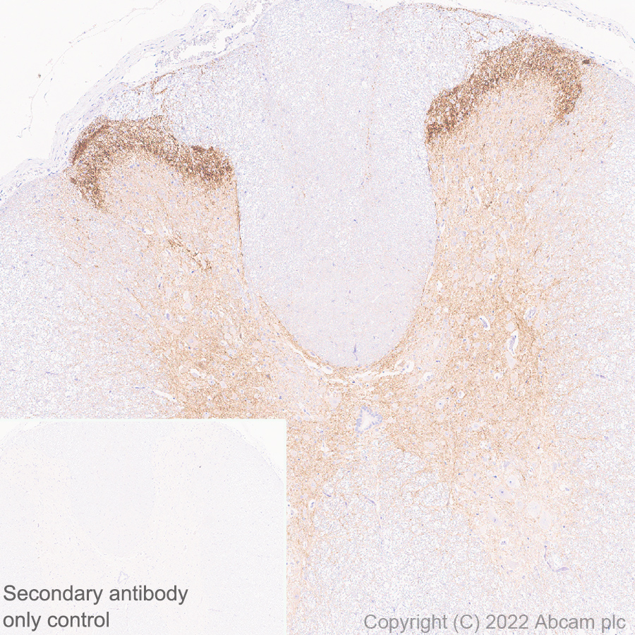 Immunohistochemistry (Formalin/PFA-fixed paraffin-embedded sections) - Anti-Mu Opioid Receptor antibody [EPR26293-61] (BSA and Azide free) (AB302513), expandable thumbnail
