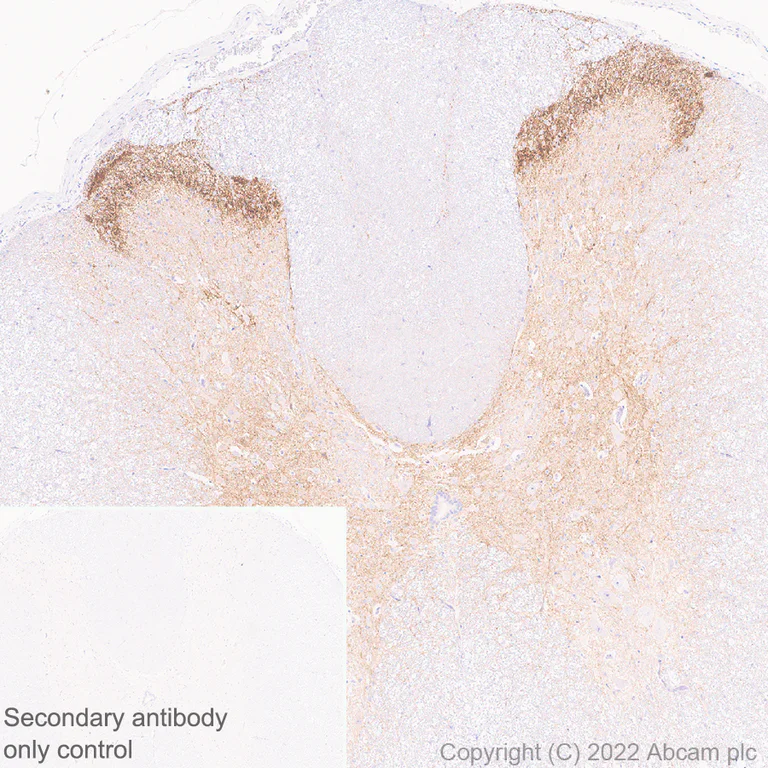Immunohistochemistry (Formalin/PFA-fixed paraffin-embedded sections) - Anti-Mu Opioid Receptor antibody [EPR26293-61] (BSA and Azide free) (AB302513)
