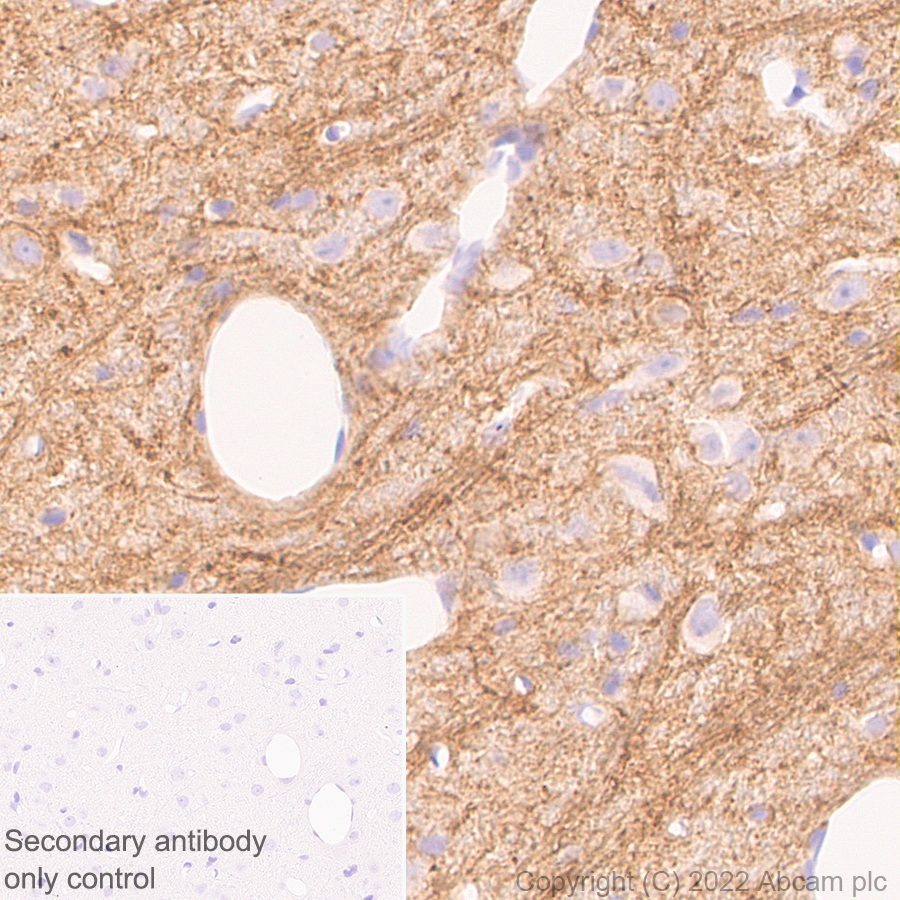 Immunohistochemistry (Formalin/PFA-fixed paraffin-embedded sections) - Anti-Mu Opioid Receptor antibody [EPR26293-61] (BSA and Azide free) (AB302513), expandable thumbnail