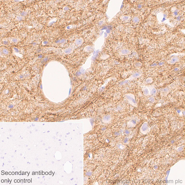 Immunohistochemistry (Formalin/PFA-fixed paraffin-embedded sections) - Anti-Mu Opioid Receptor antibody [EPR26293-61] (BSA and Azide free) (AB302513)