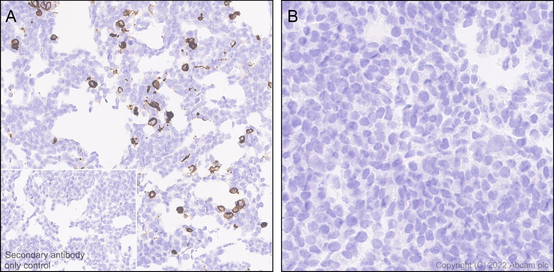 Immunohistochemistry (Formalin/PFA-fixed paraffin-embedded sections) - Anti-Mu Opioid Receptor antibody [EPR26293-61] (BSA and Azide free) (AB302513), expandable thumbnail