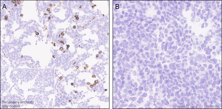 Immunohistochemistry (Formalin/PFA-fixed paraffin-embedded sections) - Anti-Mu Opioid Receptor antibody [EPR26293-61] (BSA and Azide free) (AB302513)