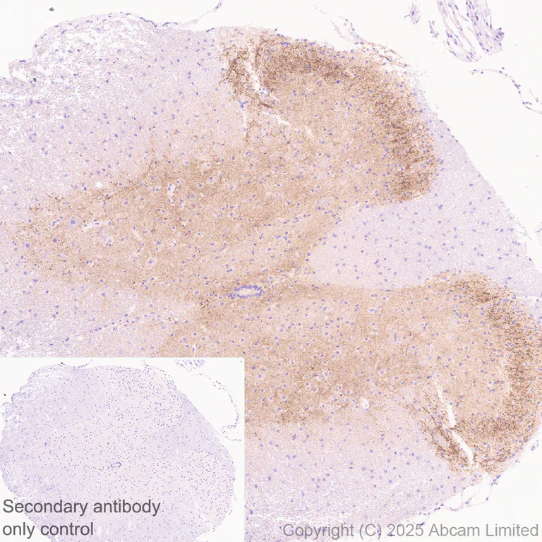 Immunohistochemistry (Formalin/PFA-fixed paraffin-embedded sections) - Anti-Mu Opioid Receptor antibody [EPR29112-126] (AB323645)