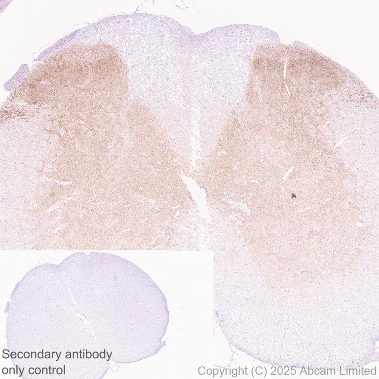 Immunohistochemistry (Formalin/PFA-fixed paraffin-embedded sections) - Anti-Mu Opioid Receptor antibody [EPR29112-126] (AB323645)
