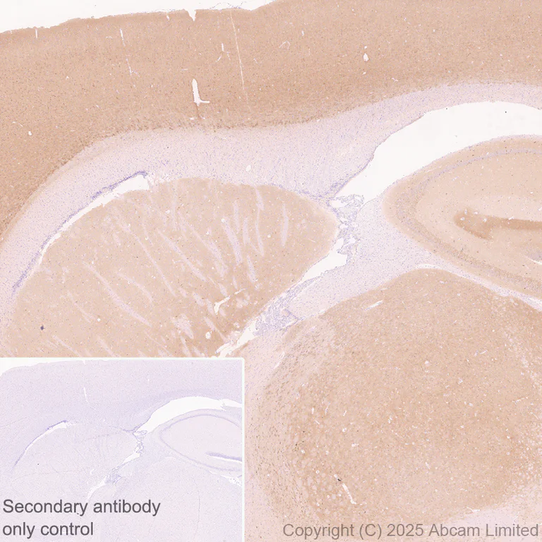 Immunohistochemistry (Formalin/PFA-fixed paraffin-embedded sections) - Anti-Mu Opioid Receptor antibody [EPR29112-126] (AB323645)