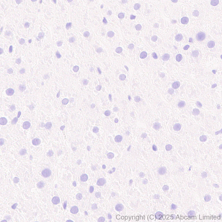 Immunohistochemistry (Formalin/PFA-fixed paraffin-embedded sections) - Anti-Mu Opioid Receptor antibody [EPR29112-126] (AB323645)
