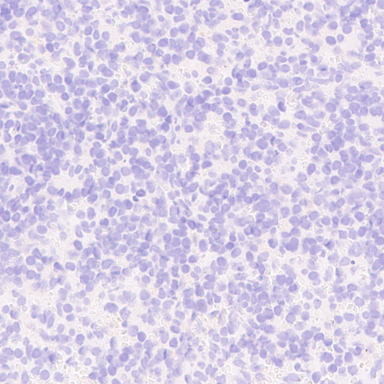 Immunohistochemistry (Formalin/PFA-fixed paraffin-embedded sections) - Anti-Mu Opioid Receptor antibody [EPR29112-126] (AB323645)