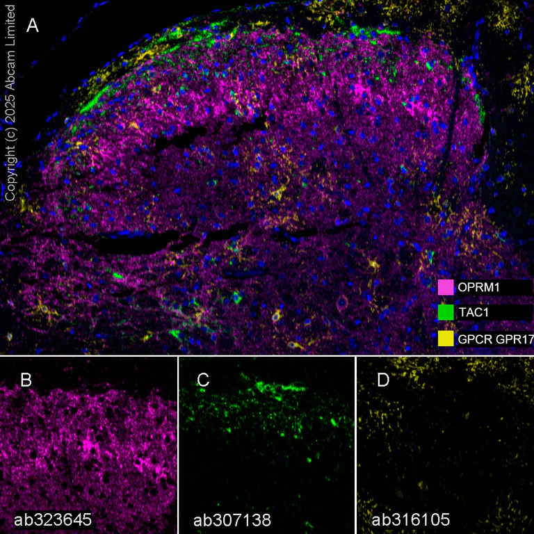 Multiplex immunohistochemistry - Anti-Mu Opioid Receptor antibody [EPR29112-126] (AB323645)
