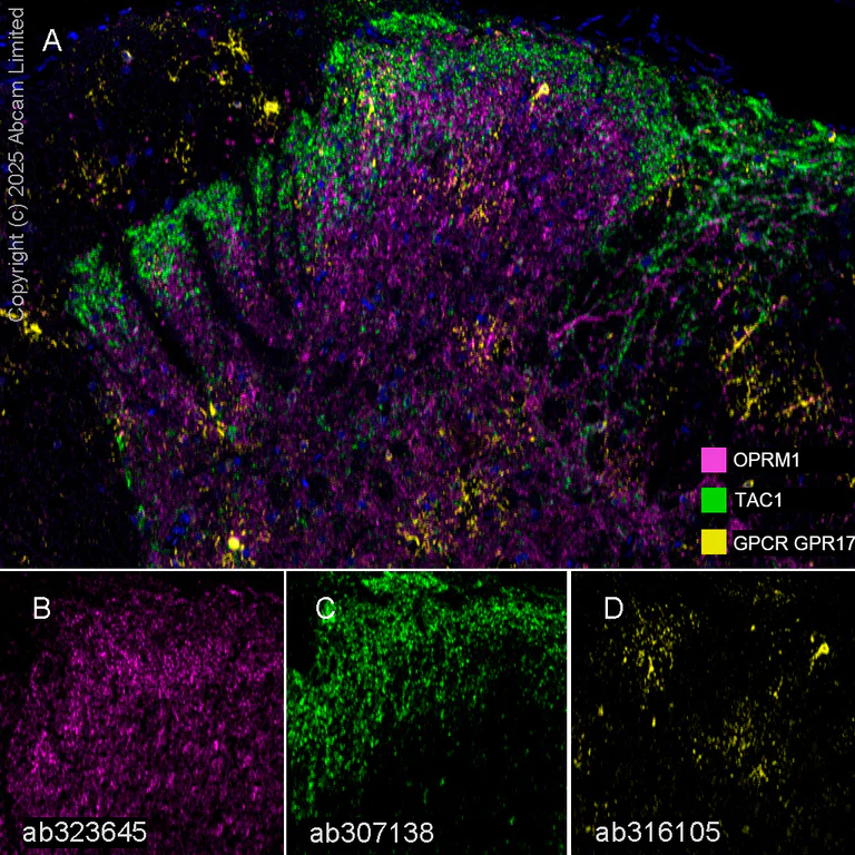 Multiplex immunohistochemistry - Anti-Mu Opioid Receptor antibody [EPR29112-126] (AB323645)