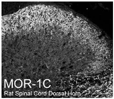 Immunohistochemistry (Frozen sections) - Anti-Mu Opioid Receptor splice variant antibody (AB10306)