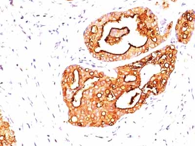 Immunohistochemistry (Formalin/PFA-fixed paraffin-embedded sections) - Anti-MUC1 antibody [139H2] (AB216611)