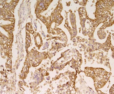 Immunohistochemistry (Formalin/PFA-fixed paraffin-embedded sections) - Anti-MUC1 antibody [BC-2] (AB89492)