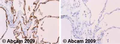 Immunohistochemistry (Formalin/PFA-fixed paraffin-embedded sections) - Anti-MUC1 antibody [C595 (NCRC48)] (AB28081)