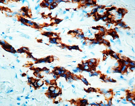 Immunohistochemistry (Formalin/PFA-fixed paraffin-embedded sections) - Anti-MUC1 antibody [E29] (AB6261)