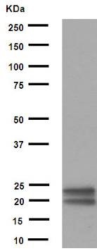 Western blot - Anti-MUC1 antibody [EPR1023] (ab109185), expandable thumbnail