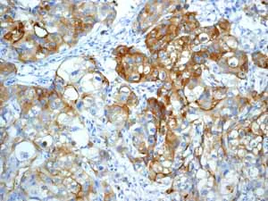 Immunohistochemistry (Formalin/PFA-fixed paraffin-embedded sections) - Anti-MUC1 antibody [EPR1023] - BSA and Azide free (AB271879)