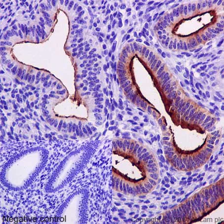 Immunohistochemistry (Formalin/PFA-fixed paraffin-embedded sections) - Anti-MUC1 antibody [EPR1023] - BSA and Azide free (AB271879)