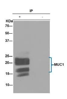 Immunoprecipitation - Anti-MUC1 antibody [EPR1023] - BSA and Azide free (AB271879)