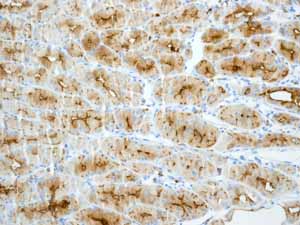 Immunohistochemistry (Formalin/PFA-fixed paraffin-embedded sections) - Anti-MUC1 antibody [EPR1023] - Low endotoxin, Azide free (ab194978), expandable thumbnail