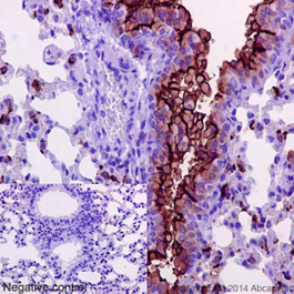 Immunohistochemistry (Formalin/PFA-fixed paraffin-embedded sections) - Anti-MUC1 antibody [EPR1023] - Low endotoxin, Azide free (AB194978), expandable thumbnail