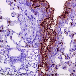 Immunohistochemistry (Formalin/PFA-fixed paraffin-embedded sections) - Anti-MUC1 antibody [EPR1023] - Low endotoxin, Azide free (AB194978)