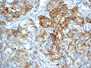 Immunohistochemistry (Formalin/PFA-fixed paraffin-embedded sections) - Anti-MUC1 antibody [EPR1023] - Low endotoxin, Azide free (ab194978), expandable thumbnail